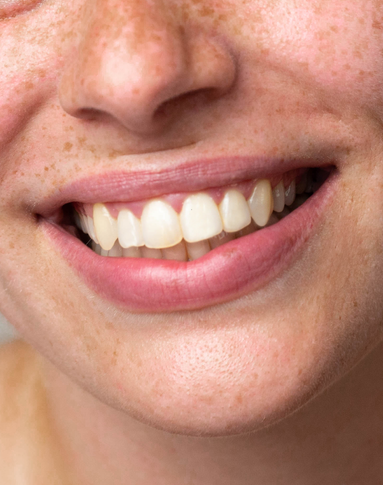 Imagen al pasar el ratón